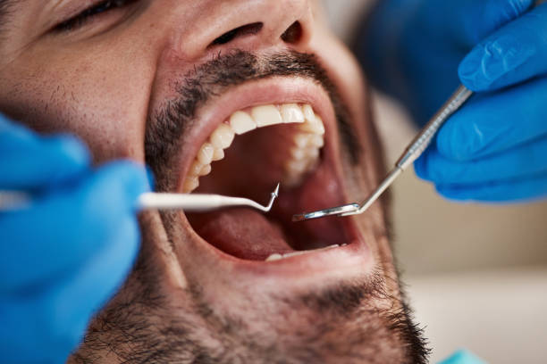 Best Emergency Dentist for Special Needs Patients in Mcqueeney, TX