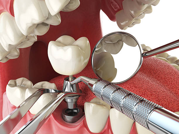 Best Weekend Emergency Dentist in Mcqueeney, TX